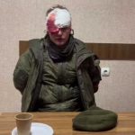 soldato-russo-ferito-ucraina